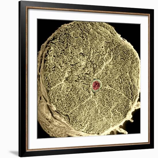 Human Spinal Nerve, SEM-Thomas Deerinck-Framed Photographic Print