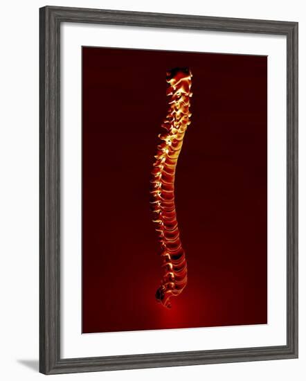 Human Spine, Artwork-PASIEKA-Framed Photographic Print