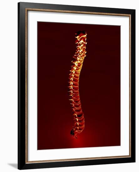 Human Spine, Artwork-PASIEKA-Framed Photographic Print