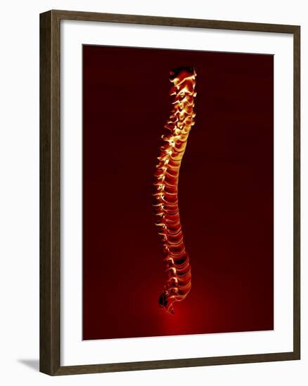 Human Spine, Artwork-PASIEKA-Framed Photographic Print