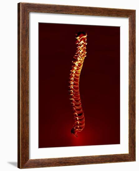 Human Spine, Artwork-PASIEKA-Framed Photographic Print