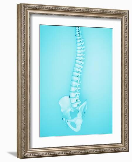 Human Spine-Lawrence Lawry-Framed Photographic Print