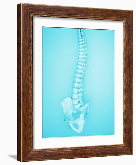 Human Spine-Lawrence Lawry-Framed Photographic Print