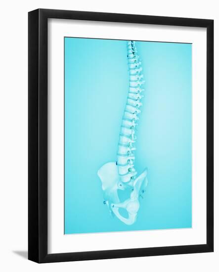 Human Spine-Lawrence Lawry-Framed Photographic Print