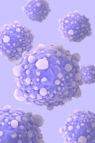 Art Print: Microscipic View of Pancreatic Cancer Cells: 18x12in