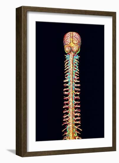 Illustration of the Human Spinal Cord And Brain-Mehau Kulyk-Framed Photographic Print