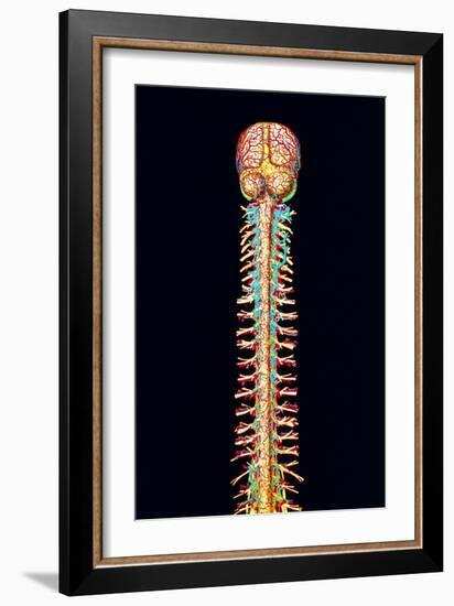 Illustration of the Human Spinal Cord And Brain-Mehau Kulyk-Framed Photographic Print