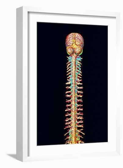 Illustration of the Human Spinal Cord And Brain-Mehau Kulyk-Framed Photographic Print