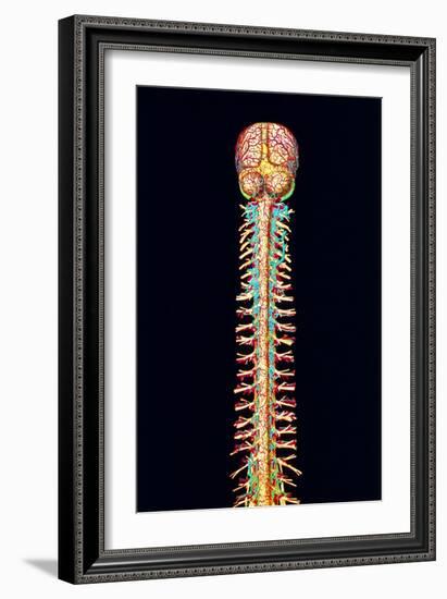 Illustration of the Human Spinal Cord And Brain-Mehau Kulyk-Framed Photographic Print