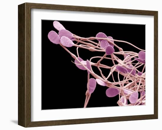 Immature Dog Sperm, SEM-Steve Gschmeissner-Framed Photographic Print