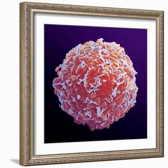 Immune System Cell, SEM-Steve Gschmeissner-Framed Premium Photographic Print