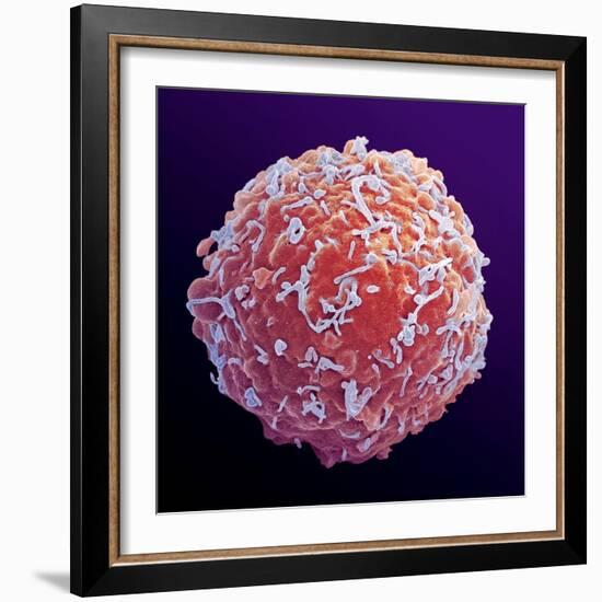 Immune System Cell, SEM-Steve Gschmeissner-Framed Premium Photographic Print