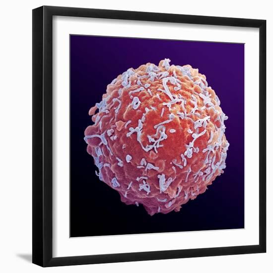 Immune System Cell, SEM-Steve Gschmeissner-Framed Premium Photographic Print