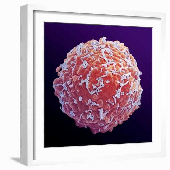 Immune System Cell, SEM-Steve Gschmeissner-Framed Premium Photographic Print