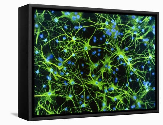 Immunofluorescent LM of Astrocyte Brain Cells-Nancy Kedersha-Framed Premier Image Canvas