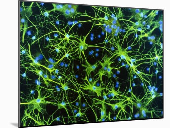 Immunofluorescent LM of Astrocyte Brain Cells-Nancy Kedersha-Mounted Photographic Print