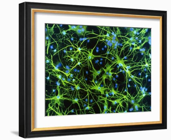 Immunofluorescent LM of Astrocyte Brain Cells-Nancy Kedersha-Framed Photographic Print