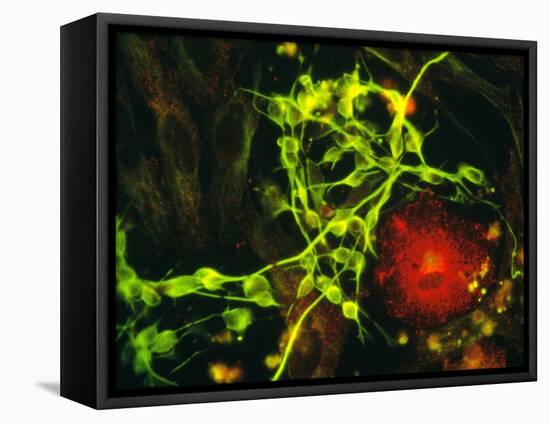 Immunofluorescent LM of Macrophage In Brain Tissue-Nancy Kedersha-Framed Premier Image Canvas