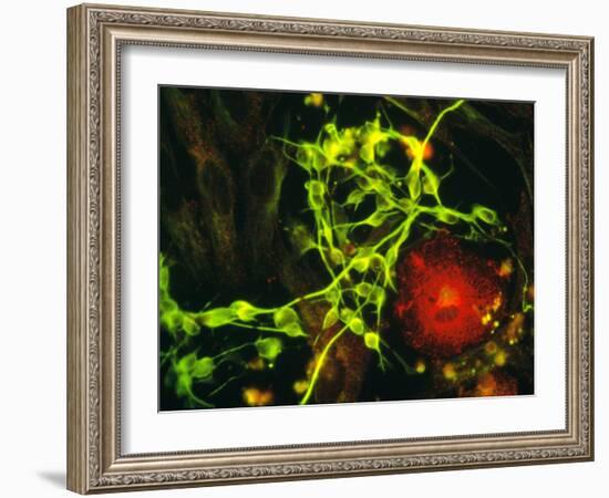 Immunofluorescent LM of Macrophage In Brain Tissue-Nancy Kedersha-Framed Photographic Print