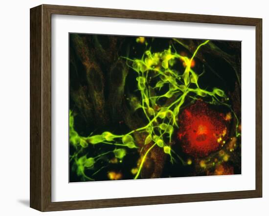 Immunofluorescent LM of Macrophage In Brain Tissue-Nancy Kedersha-Framed Photographic Print