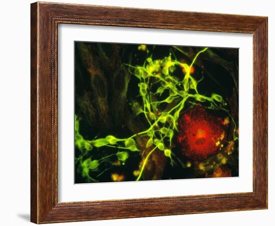 Immunofluorescent LM of Macrophage In Brain Tissue-Nancy Kedersha-Framed Photographic Print