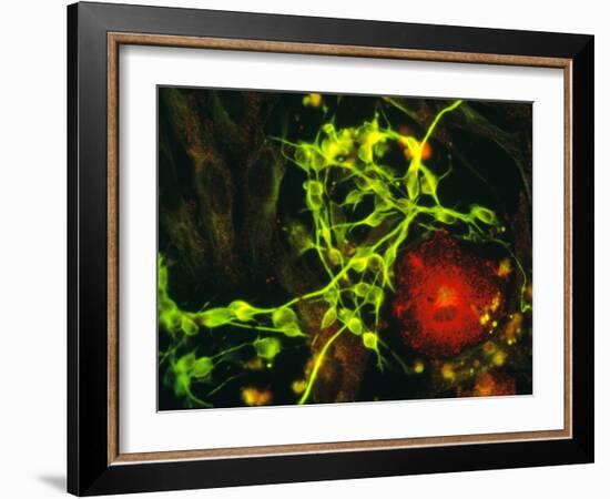 Immunofluorescent LM of Macrophage In Brain Tissue-Nancy Kedersha-Framed Photographic Print