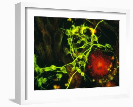 Immunofluorescent LM of Macrophage In Brain Tissue-Nancy Kedersha-Framed Photographic Print