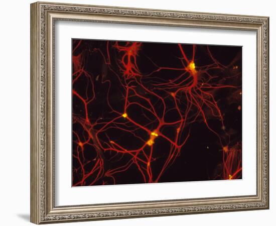 Immunofluorescent LM of Mammalian Brain Astrocytes-Nancy Kedersha-Framed Photographic Print