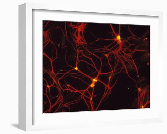 Immunofluorescent LM of Mammalian Brain Astrocytes-Nancy Kedersha-Framed Photographic Print