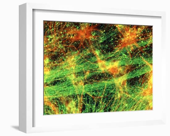Immunofluorescent LM of Neurons & Astrocytes-Nancy Kedersha-Framed Photographic Print