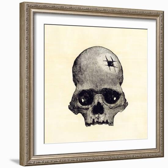 Inca Skull Showing Evidence of Prehistoric Trephining or Brain Surgery in Peru-null-Framed Giclee Print