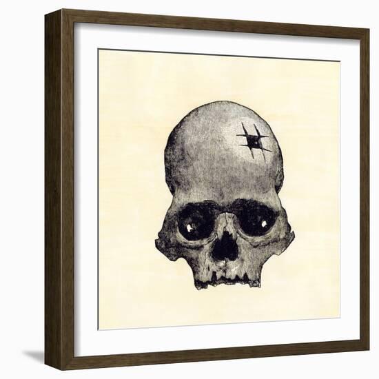 Inca Skull Showing Evidence of Prehistoric Trephining or Brain Surgery in Peru-null-Framed Giclee Print