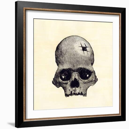 Inca Skull Showing Evidence of Prehistoric Trephining or Brain Surgery in Peru-null-Framed Giclee Print