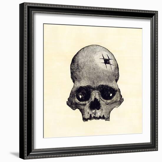 Inca Skull Showing Evidence of Prehistoric Trephining or Brain Surgery in Peru-null-Framed Giclee Print