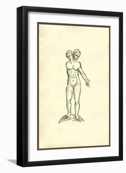 Infans Biceps Unico Brachio-Ulisse Aldrovandi-Framed Art Print