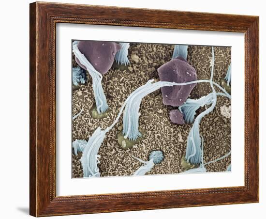 Inner Ear Sensory Cells, SEM-Steve Gschmeissner-Framed Photographic Print