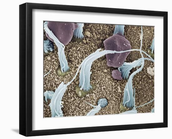 Inner Ear Sensory Cells, SEM-Steve Gschmeissner-Framed Photographic Print