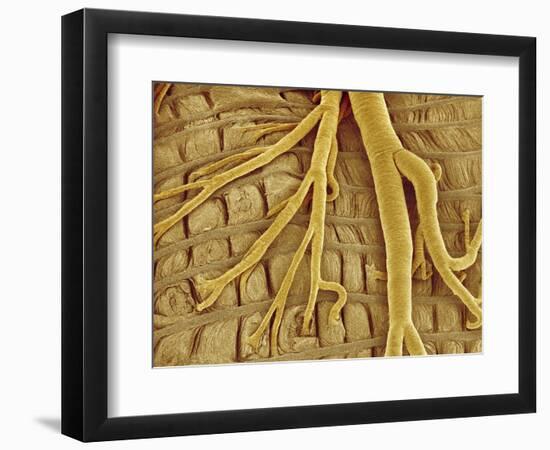 Interior of moth larva-Micro Discovery-Framed Photographic Print