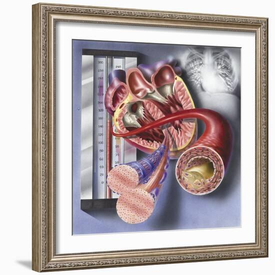 Interior View of Heart with Detail of Muscle Cells and Atherosclerotic Artery-null-Framed Art Print