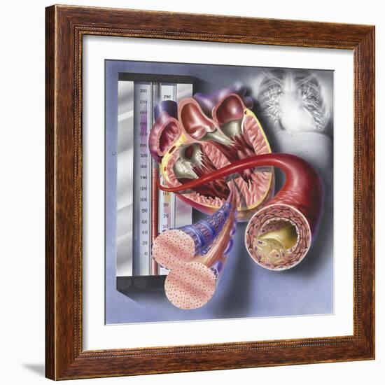 Interior View of Heart with Detail of Muscle Cells and Atherosclerotic Artery-null-Framed Art Print