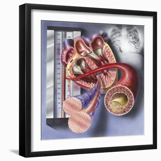 Interior View of Heart with Detail of Muscle Cells and Atherosclerotic Artery-null-Framed Art Print