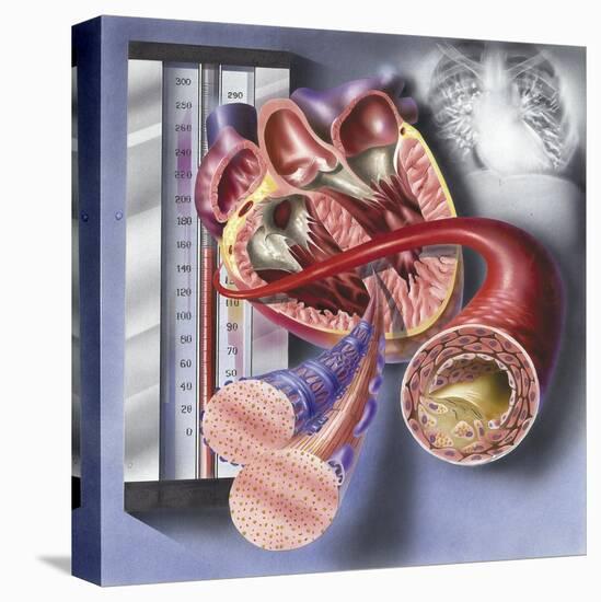 Stretched Canvas Print, , large