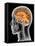 Internal Brain Anatomy, Artwork-PASIEKA-Framed Premier Image Canvas
