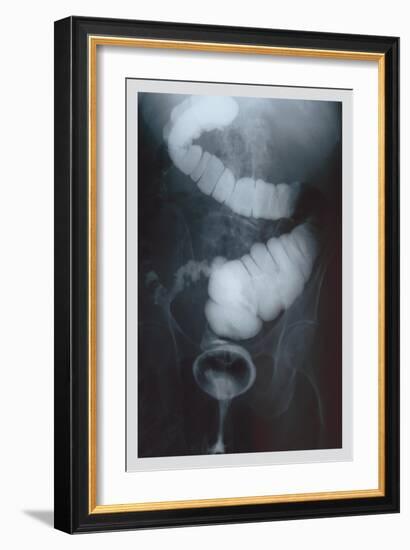 Intestine Barium-null-Framed Premium Giclee Print