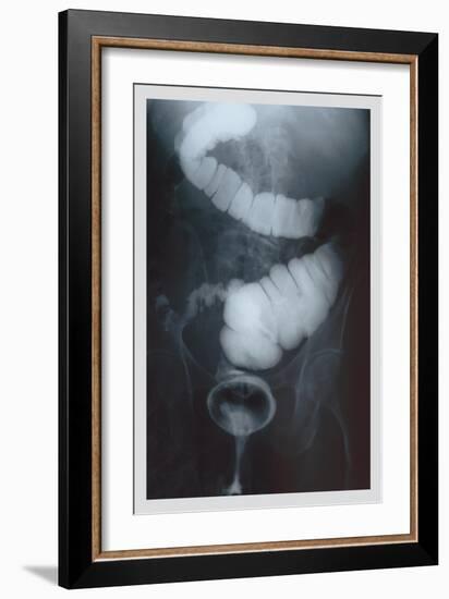 Intestine Barium-null-Framed Art Print