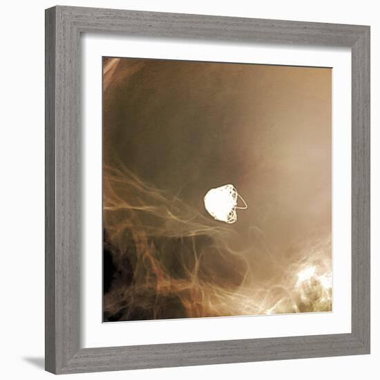 Intracranial Berry Aneurysm, X-ray-ZEPHYR-Framed Premium Photographic Print