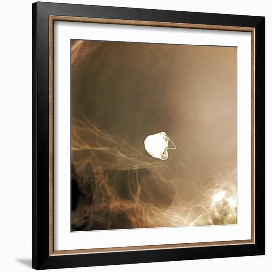 Intracranial Berry Aneurysm, X-ray-ZEPHYR-Framed Premium Photographic Print