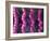 Irritable Bowel Syndrome-David Mack-Framed Photographic Print