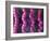 Irritable Bowel Syndrome-David Mack-Framed Photographic Print