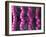 Irritable Bowel Syndrome-David Mack-Framed Photographic Print